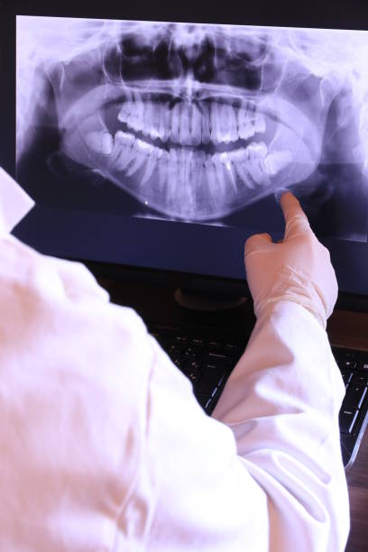 Best Emergency Wisdom Teeth Removal in Ephraim, UT