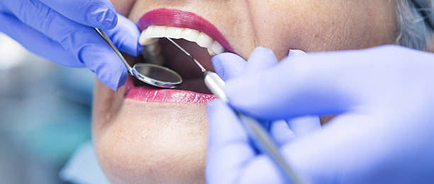 Best Emergency Tooth Extraction in Ephraim, UT